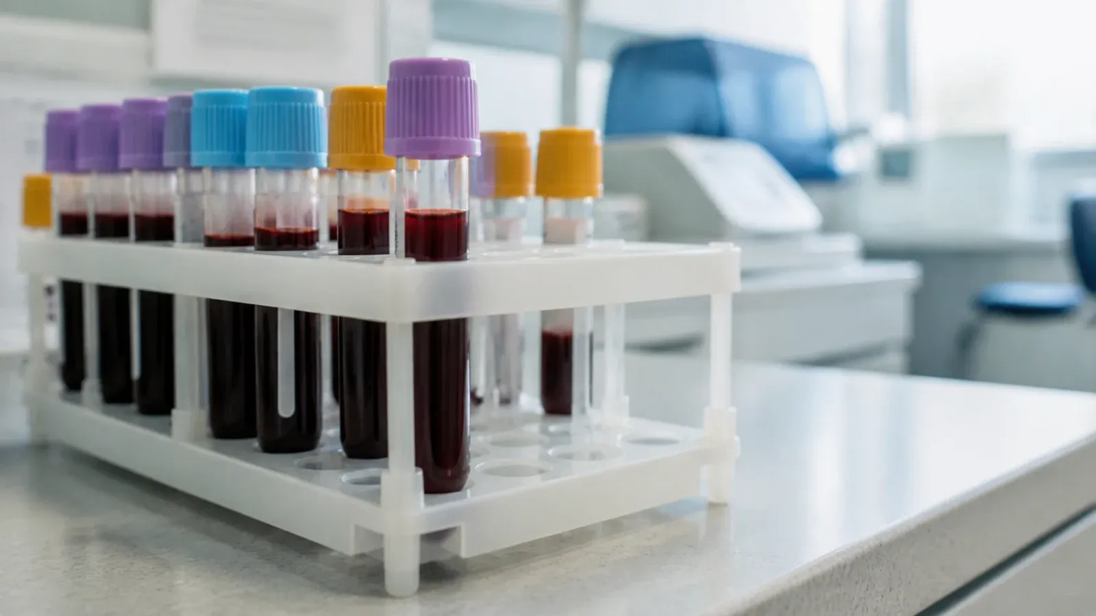 Statyw z probówkami do morfologii krwi na blacie laboratorium