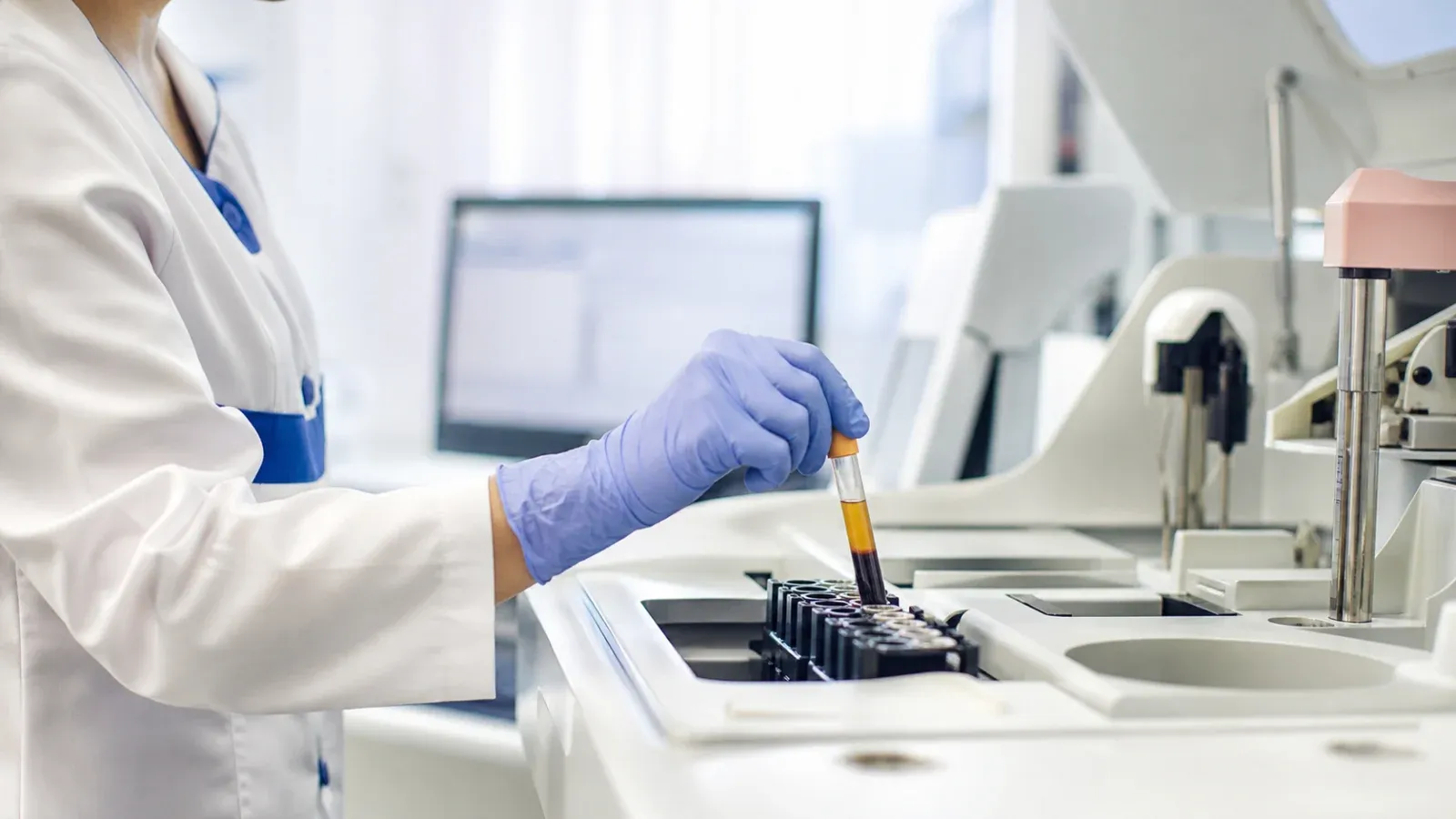 Diagnostka laboratoryjna umieszczająca probówkę z surowicą w analizatorze