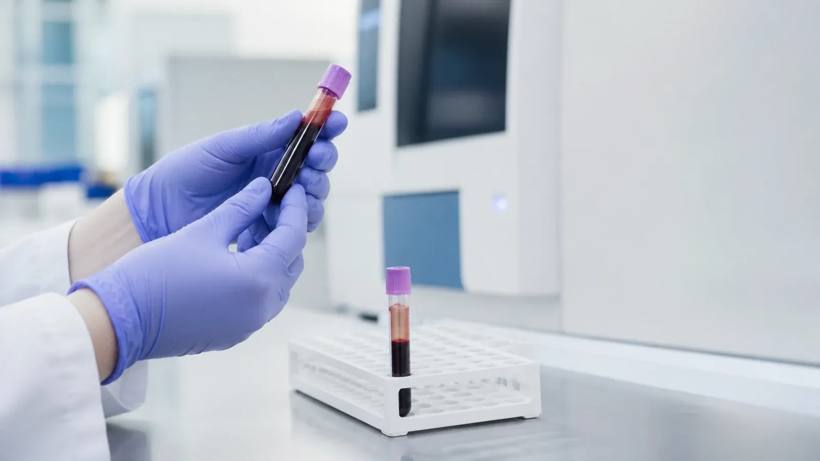 Diagnosta laboratoryjny porównujący dwie zamknięte probówki przy statywie.